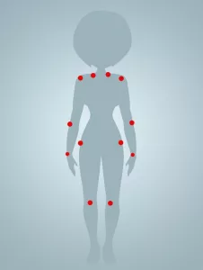 Bild: Mensch-Silhouette mit roten Schmerzpunkten